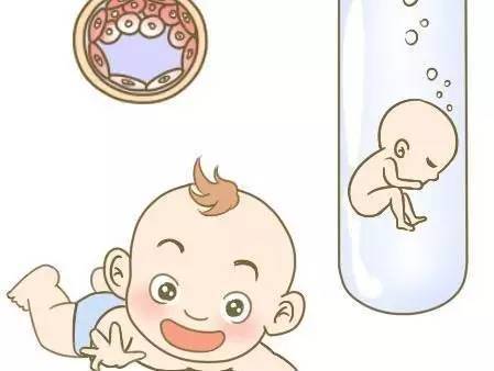 体外受精 IVF-ET